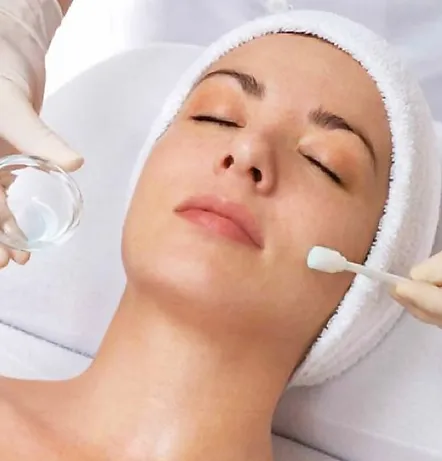 chemical peel facial in scottsdale