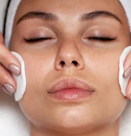 chemical peel treatment in scottsdale