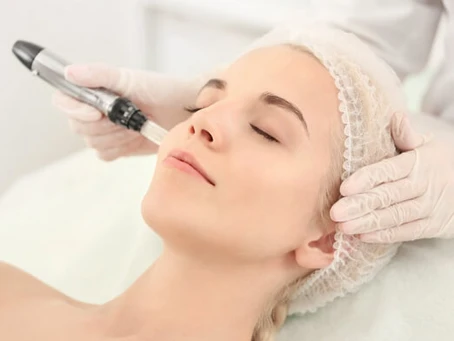 Microneedling