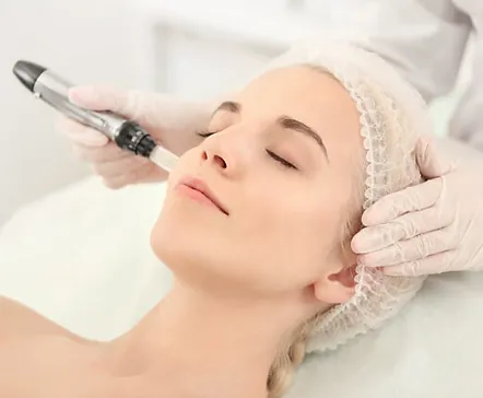 Microneedling Treatment in Scottsdale