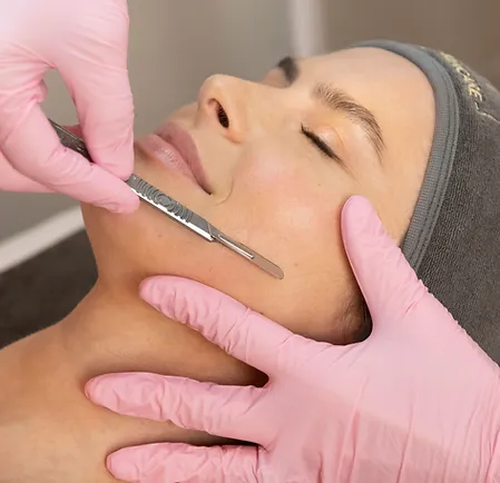 Best Dermaplane Treatment in Scottsdale