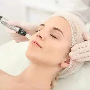 Microneedling Treatment